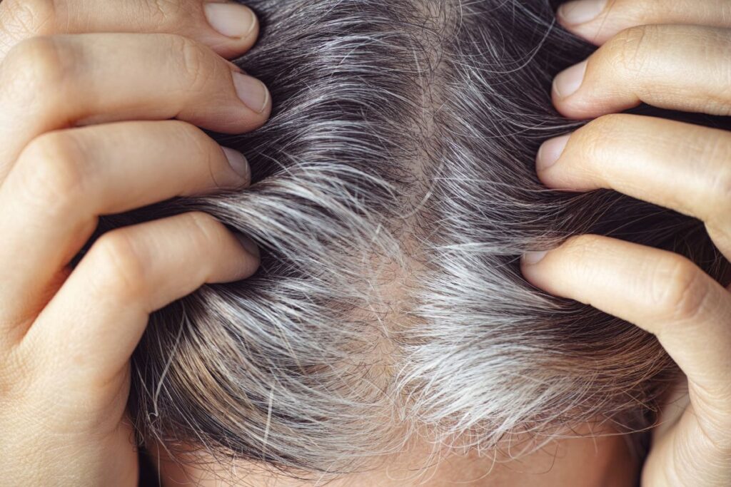 Reverse Gray Hair From Stress